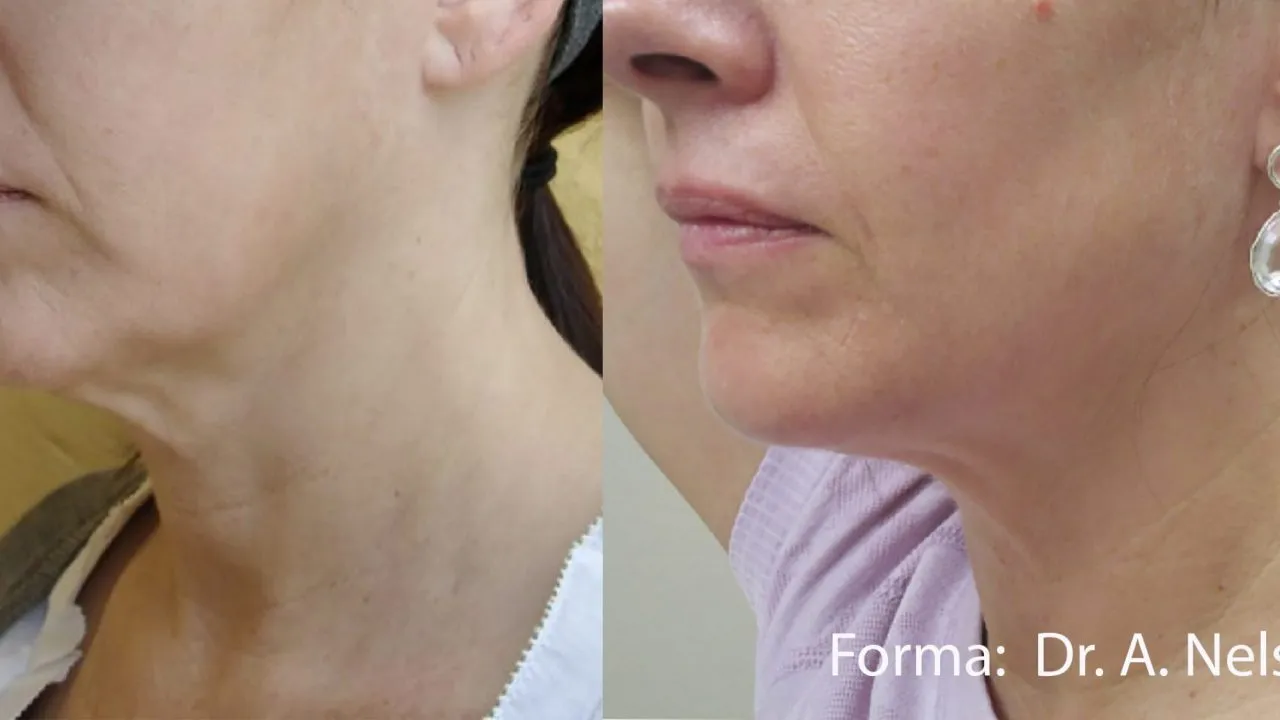 forma before after dr a nelson preview 1 (1)